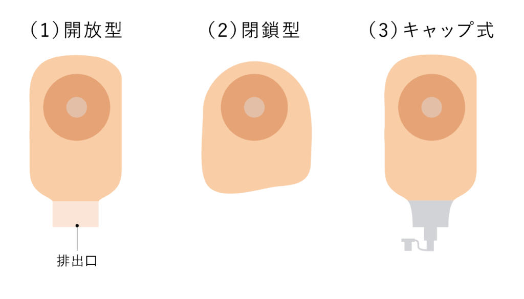 手術後に覚えておきたい | ホリスターブログ