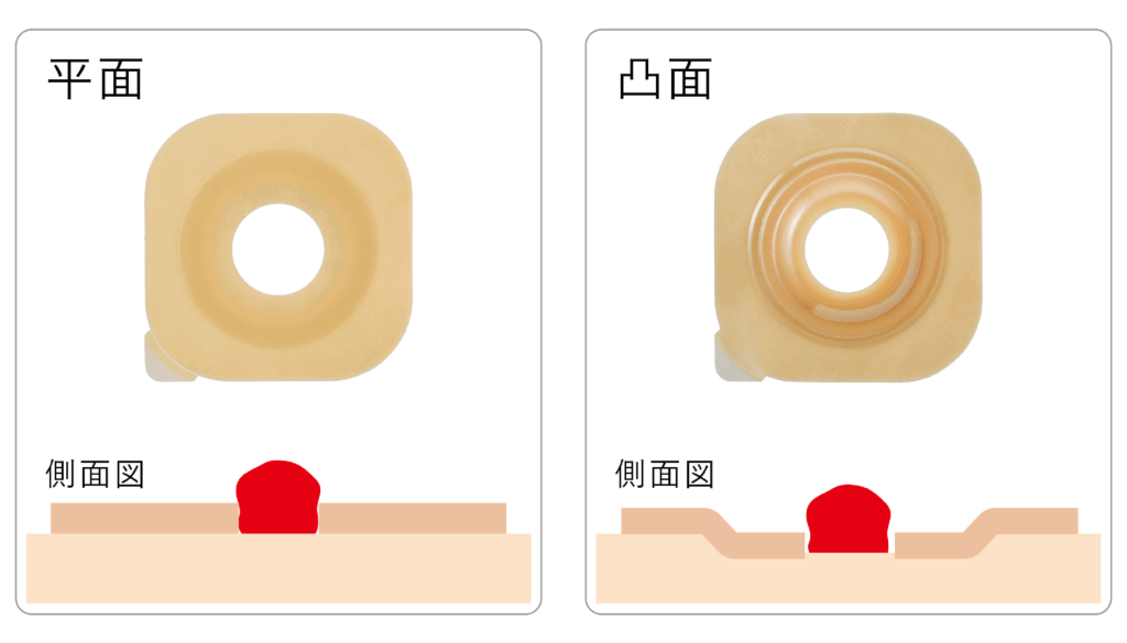 手術後に覚えておきたい | ホリスターブログ